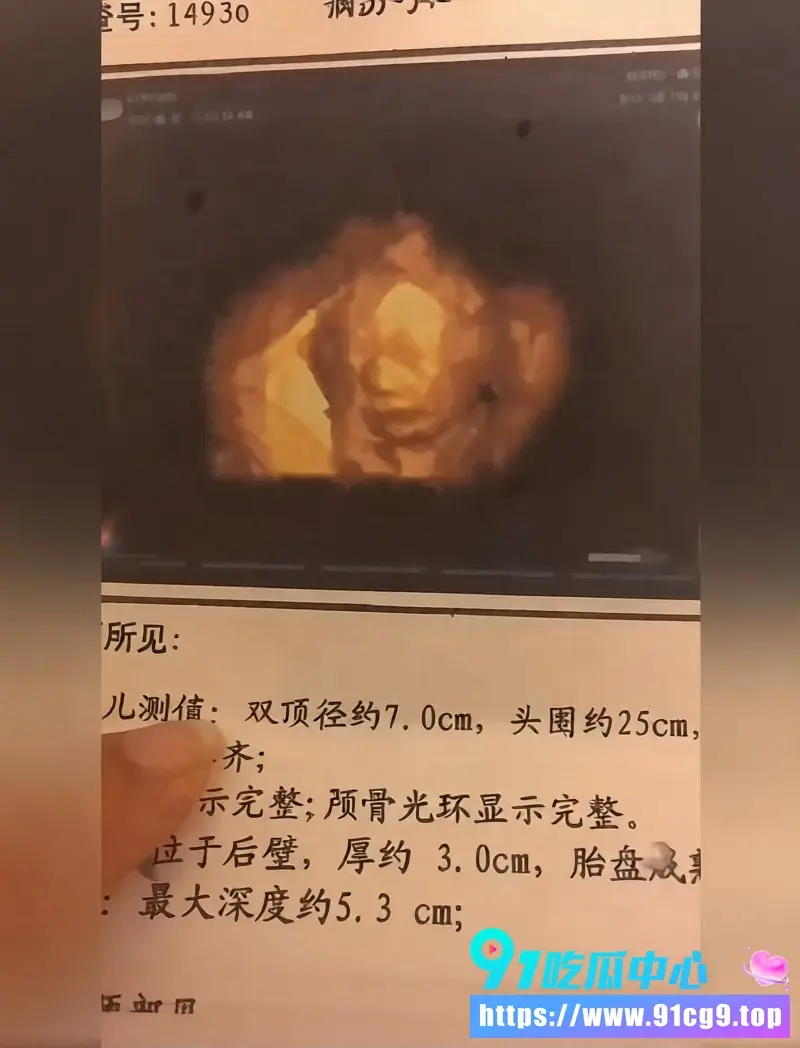 家暴往事 (5).webp
